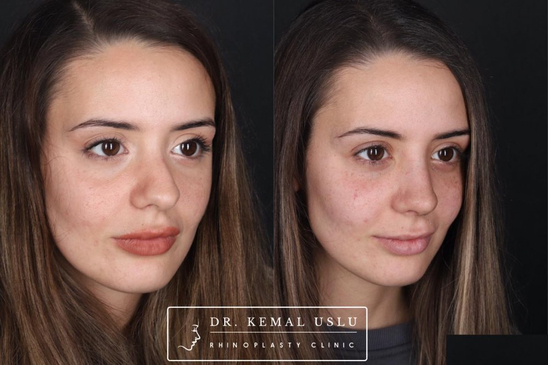 Slider image (5) Dr. Kemal Uslu Clinic